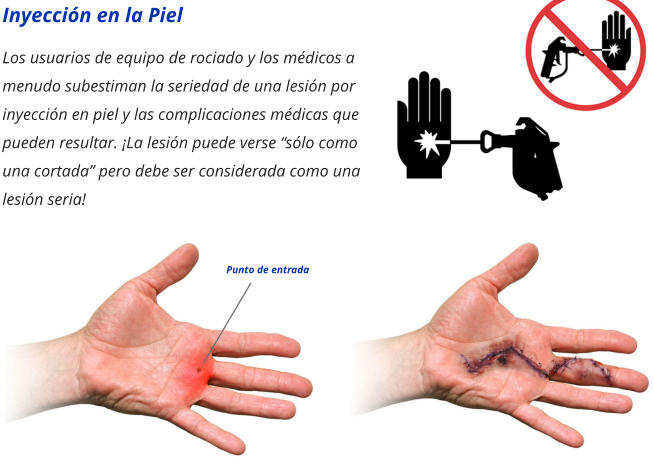 Inyección en la Piel Los usuarios de equipo de rociado y los médicos a menudo subestiman la seriedad de una lesión por inyección en piel y las complicaciones médicas que pueden resultar. ¡La lesión puede verse “sólo como una cortada” pero debe ser considerada como una lesión seria! Punto de entrada